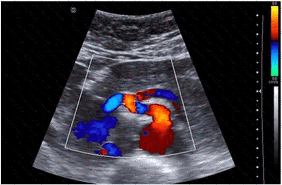 AB-Abdomen question answer