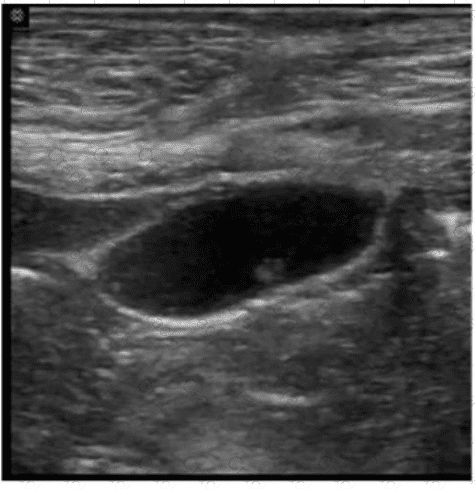 AB-Abdomen question answer
