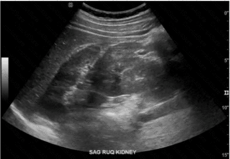 AB-Abdomen question answer