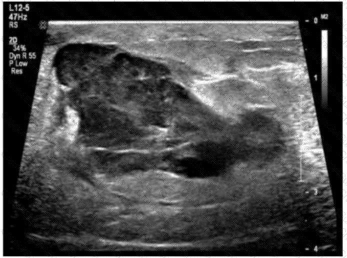 AB-Abdomen question answer