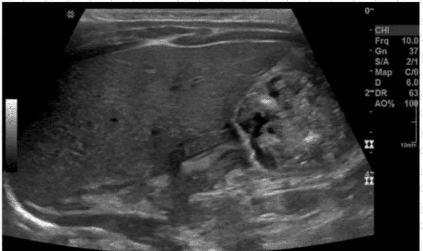 AB-Abdomen question answer