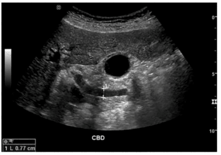 AB-Abdomen question answer