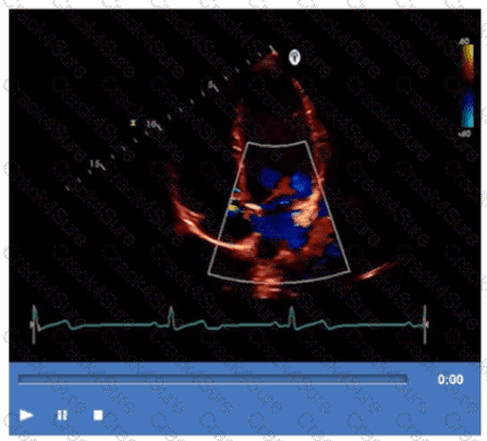 AE-Adult-Echocardiography question answer