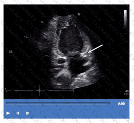 AE-Adult-Echocardiography question answer
