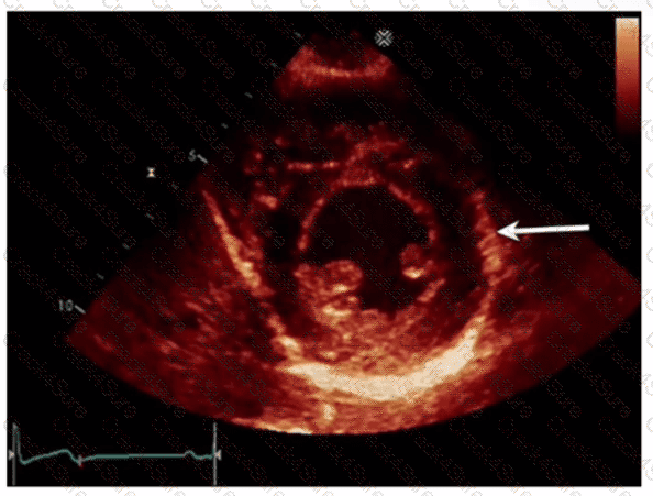 AE-Adult-Echocardiography question answer