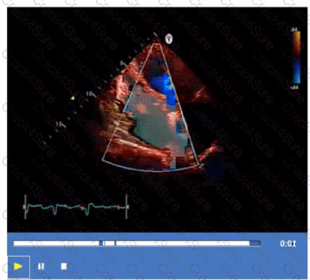 AE-Adult-Echocardiography question answer
