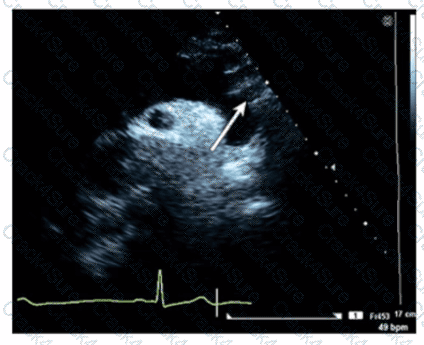 AE-Adult-Echocardiography question answer