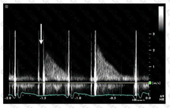 AE-Adult-Echocardiography question answer