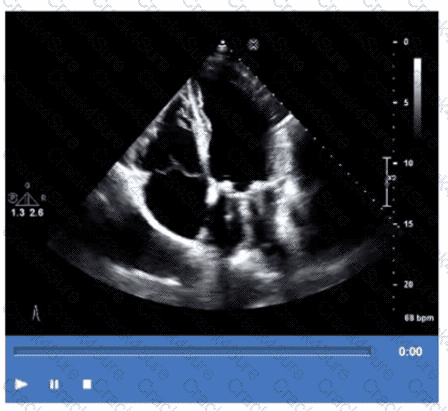 AE-Adult-Echocardiography question answer
