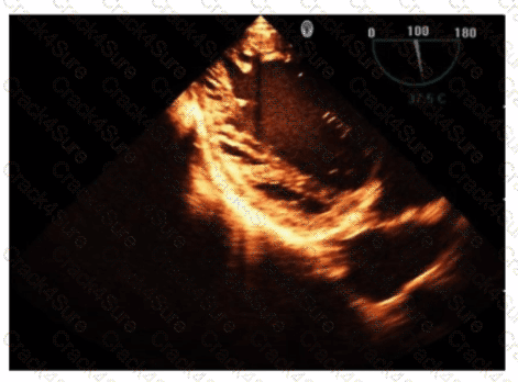AE-Adult-Echocardiography question answer