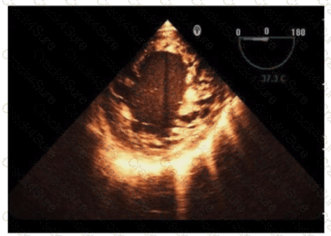 AE-Adult-Echocardiography question answer