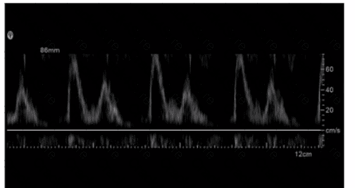 SPI question answer